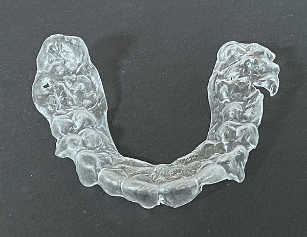 Retainer